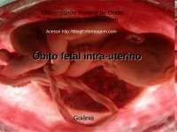 ôbito fetal intra-uterino