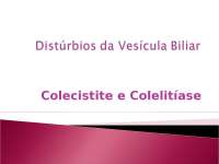Colelitíase e Colecistite