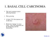 Basal Cell Carcinoma - Dermatology - Lecture Slides
