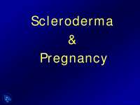 Scleroderma and Pregnancy - Dermatology - Lecture Slides