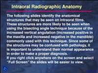 Intraoral Radiographic Anatomy - Dental Radiology - Lecture Slides
