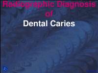 Radiographic Diagnosis of Dental Caries - Dental Radiology - Lecture Slides