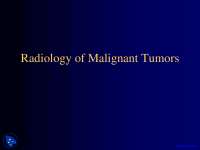 Radiology of Malignant Tumors - Dental Radiology - Lecture Slides