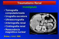 Traumatismo Urogenital - Apostilas - urologia Parte2