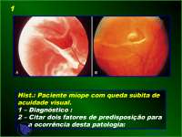 Estudo dirigido - Apostilas - oftalmologia