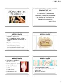 Cirurgia Plastica