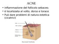 L'acne