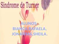 SINDROME DE TURNE