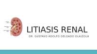 Litiasis renal: fisiopatología, clínica y tratamiento