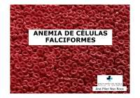 Anemia Falciforme drepanocitica de los glublos rojos