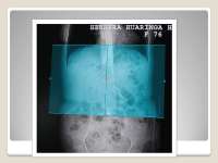 TOMOGRAFIA DE ABDOMEN ANATOMIA