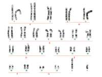 Cariotipo de cromosomas humano - Docsity