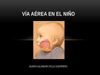 vía aérea pediátrica