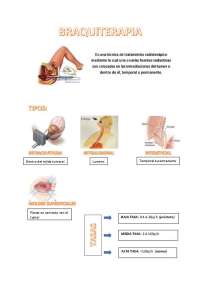 Radioterapia para TERT