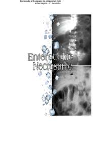 Enterocolite Necrosante