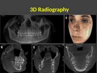 CBCT in dental radiography