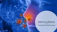 Rinitis alérgica, presentación de un artículo de revisión.