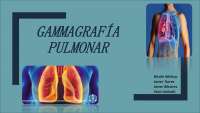 Gammagraía pulmonar de ventilación/perfusión