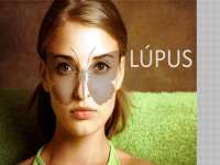 Lúpus - mecanismo de ataque e defesa