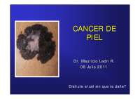 EVAUACIÓN Y MANEJO DEL CANCER DE PIEL
