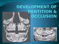 occlusion and developement of dentition