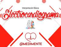 electrocardiograma interpretacion