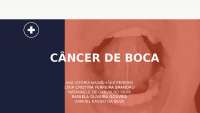 Câncer de boca - O que é? quais são as causas? quais possíveis tratamento?