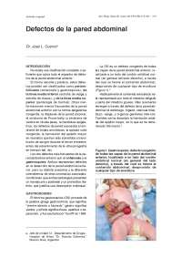 Manejo Prenatal y Quirúrgico de Gastrosquisis y Onfalocele: Un Análisis Completo