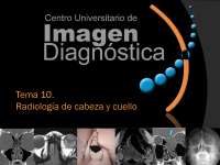 Anatomía y Patología de Radiología de Cabeza y Cuello: Senos Paranasales y Osteomeatal - P