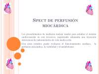 SPECT Perfusión Miocárdica f