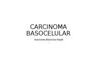 Carcinoma basocelular completo