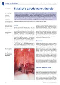 Plastische parodontale chirurgie