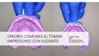 Errores en la toma de impresion