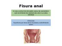 fisuras y abscesos anales