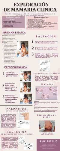 Exploración de mama