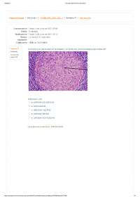 Examen de Linfoma de Hodking