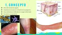 celulitis enfermedad