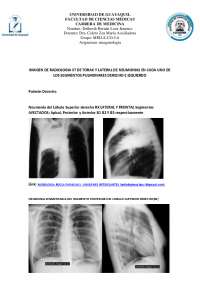 IMAGEN DE RADIOLOGIA ST DE TORAX Y LATERAL DE NEUMONIAS