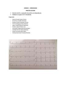 Análisis EKG: Frecuencia Cardíaca, Ritmo, Eje Eléctrico y Otros Parámetros