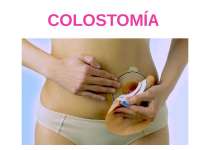 cuidado de enfermero colostomia