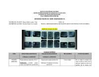 Interpretación Radiográfica