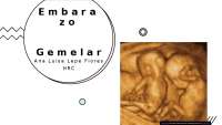 Embarazo gemelar incidencia y diagnostico