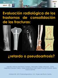 ¿retardo o pseudoartrosis?