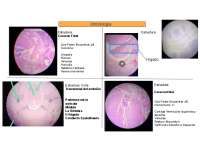 Anatomía del Corazón Fetal: Partes Importantes y Su Estructura