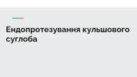 Ендопротезування кульшового суглоба