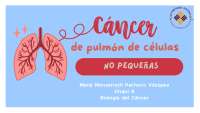 Cáncer de pulmon de células no pequeñas