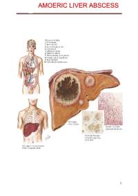 LIVER ABSCESS IMPORTANT NOTES