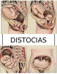 Revisión bibliográfica de distocias