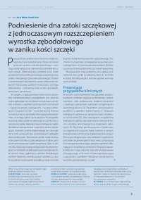 Podniesienie dna zatoki szczękowej z jednoczasowym ...
