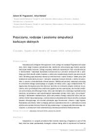 Przyczyny, rodzaje i poziomy amputacji kończyn dolnych